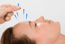 Photo of The Benefits of Acupuncture for Addiction Treatment as Per Our Houston Acupuncture Clinic.